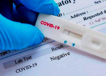 El Gobierno dice que "las primeras pruebas del test rápido se realizaron en paralelo en un hospital de Madrid y en el ISCIII".