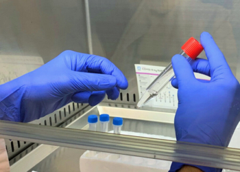 La mejor prueba para detectar la infección por SARS-CoV-2 es la PCR nasofaríngea. gracias a su alta sensibilidad del 98%.