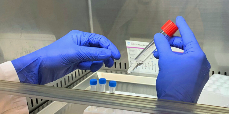 La mejor prueba para detectar la infección por SARS-CoV-2 es la PCR nasofaríngea. gracias a su alta sensibilidad del 98%.
