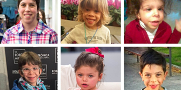 El síndrome de Williams, protagonista de la gala benéfica de San Patricio en Madrid