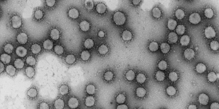 Ocho centros españoles participan en la investigación europea sobre el coronavirus