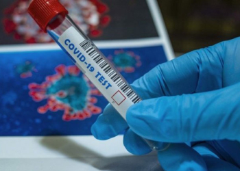 La prevalencia de la COVID-19 en los viajeros se estima inferior a la prevalencia entre la población en general.