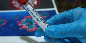 La prevalencia de la COVID-19 en los viajeros se estima inferior a la prevalencia entre la población en general.